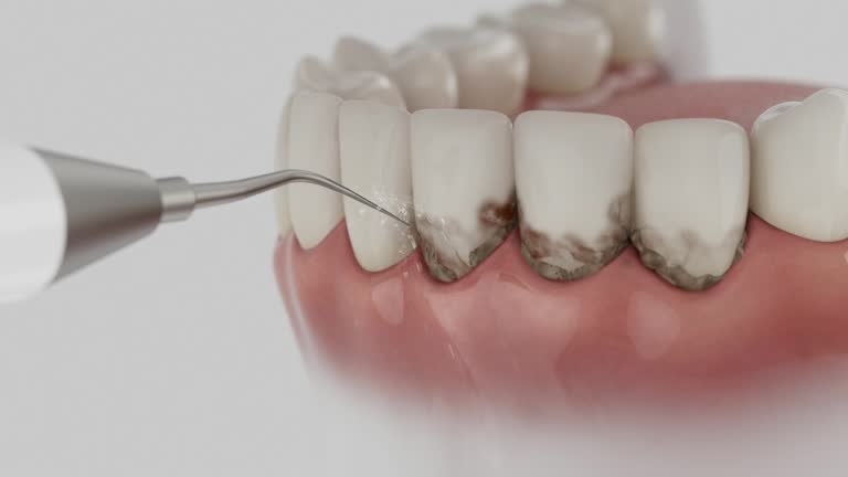 Reliable Dental Implants contractor in Princeton Junction, NJ by Smile Center Dentistry